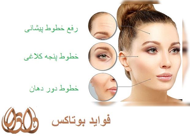 فواید تزریق ژل و بوتاکس