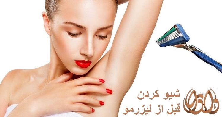 نکات ایمنی برای انجام لیزر موهای زائد