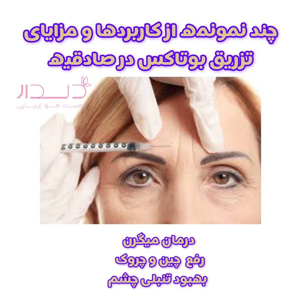 مزایا و کاربرد تزریق بوتاکس در صادقیه