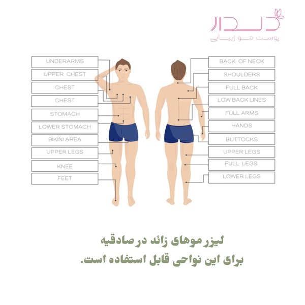 نواحی قابل درمان با لیزر موهای زائد در صادقیه