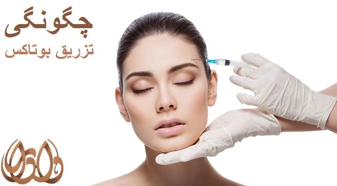 تزریق بوتاکس چگونه است؟