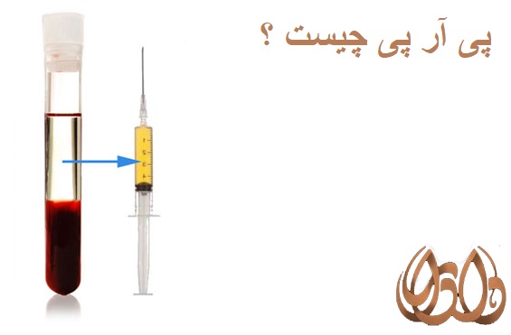 پی آر پی چیست؟