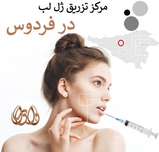 مرکز تزریق ژل لب در فردوس