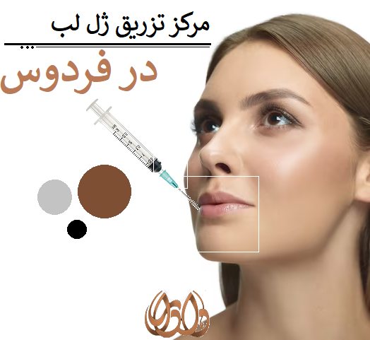 مرکز تزریق ژل لب در فردوس