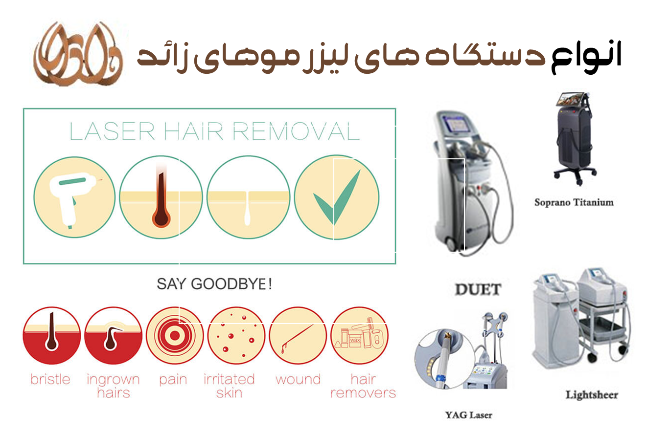 انواع دستگاه های لیزر