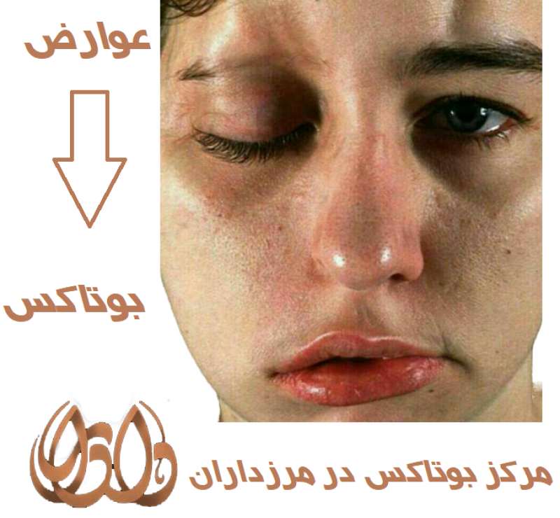 مرکز بوتاکس در مرزداران