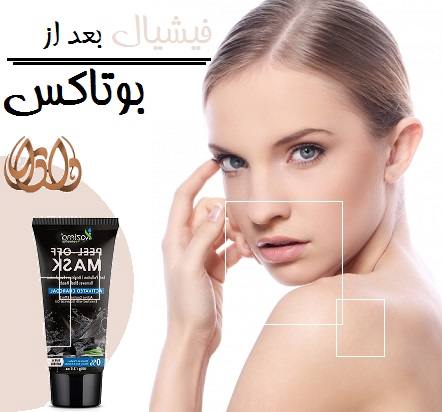 فیشیال بعد از بوتاکس