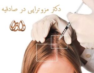 دکتر مزوتراپی در صادقیه