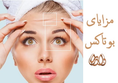 مزایای بوتاکس