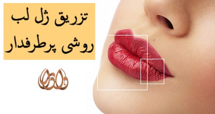 تزریق ژل لب روشی پرطرفدار