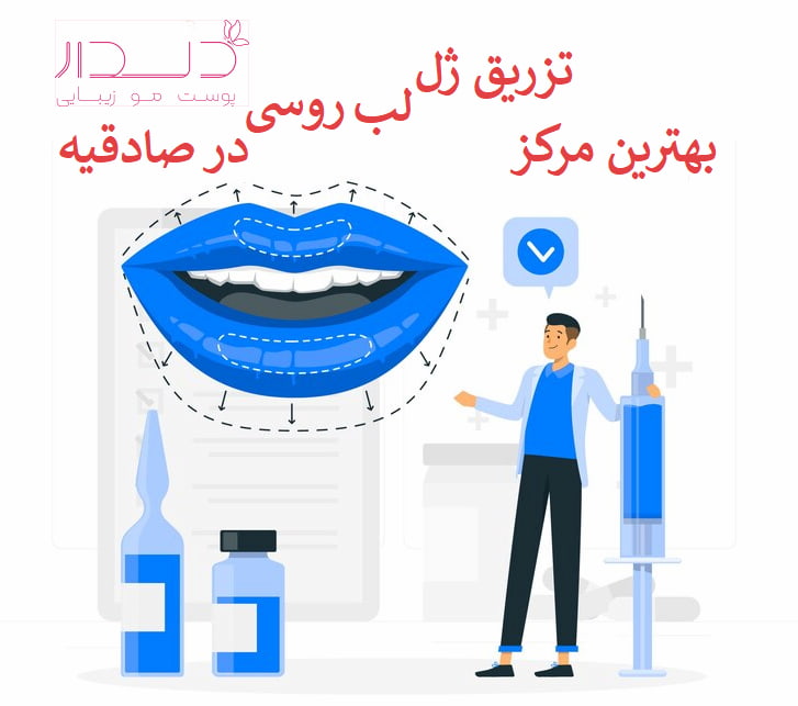 بهترین مرکز تزریق ژل لب روسی