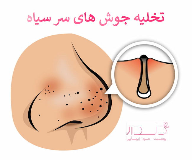 بهترین مرکز آموزش فیشیال صورت در صادقیه