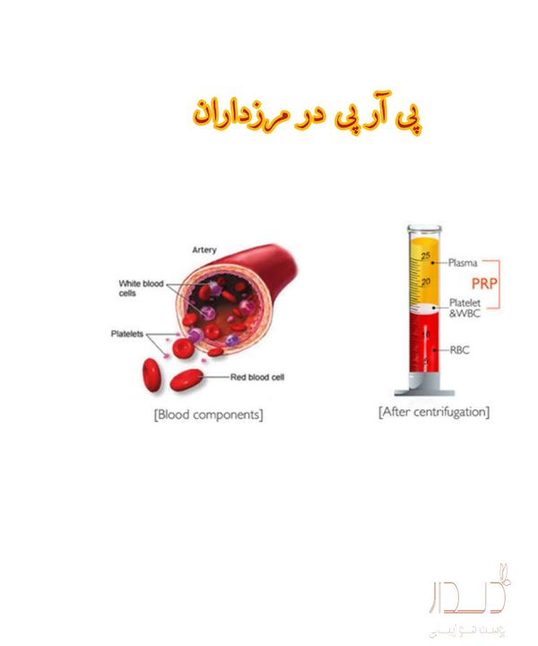 بهترین مرکز پی آر پی در مرزداران تهران