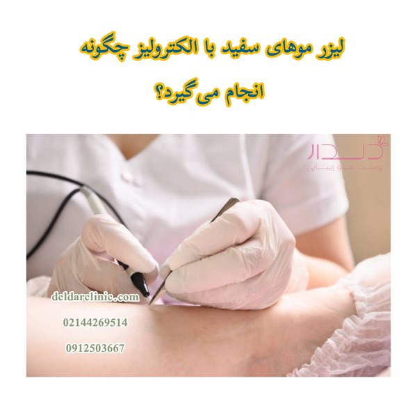 الکترولیز چگونه انجام می‌گیرد