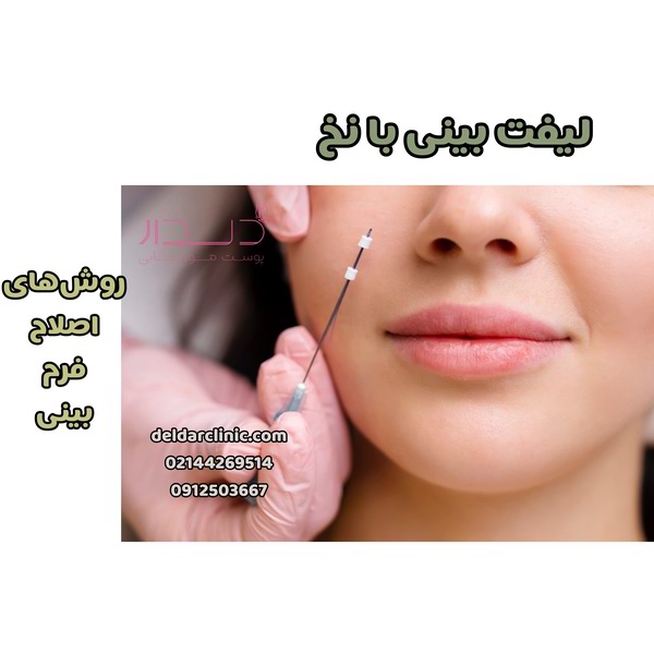 روش‌های اصلاح فرم بینی ؛ لیفت با نخ