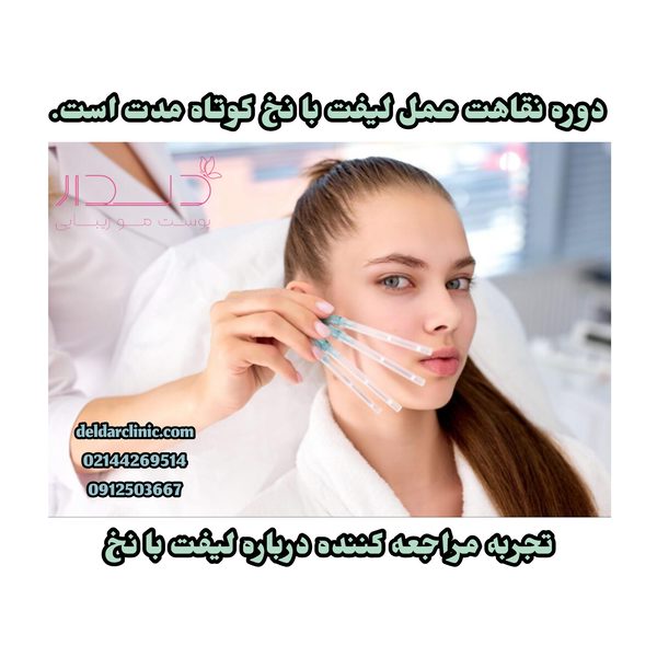 تجربه مراجعه کننده درباره لیفت با نخ و دوره نقاهت آن