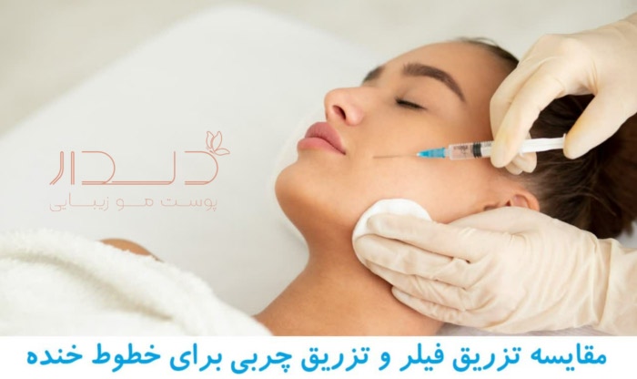 برای خط خنده تزریق ژل بهتر است یا چربی؟؟