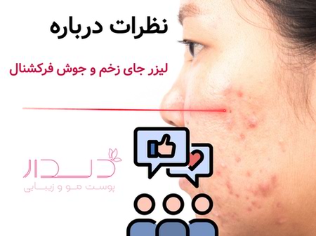 نظرات درباره لیزر جای جوش و زخم