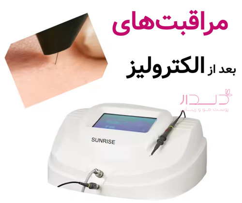 مراقبت بعد از الکترولیز