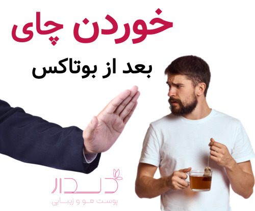 خوردن چای بعد از بوتاکس بعد بوتاکس چی بخوریم؟