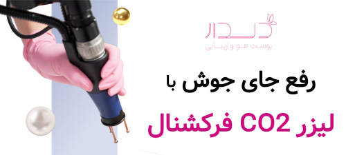 رفع جای جوش با لیزر co2 فرکشنال