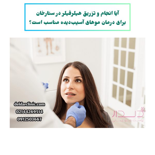 تزریق هیرفیلر در ستارخان برای موهای آسیب دیده مناسب است؟