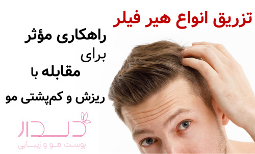 تزریق انواع هیرفیلر؛ راهکاری مؤثر برای مقابله با ریزش و کم‌پشتی مو