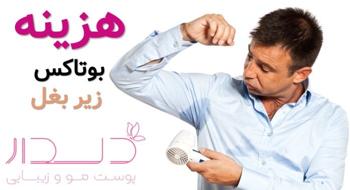 هزینه بوتاکس زیر بغل قیمت بوتاکس زیر بغل