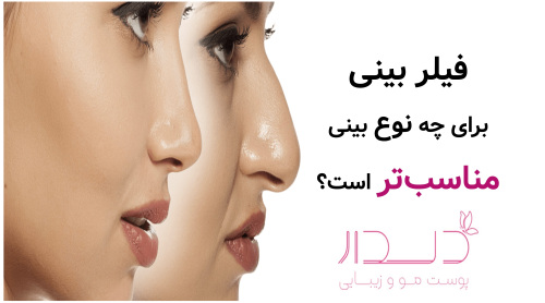 فیلر بینی برای چه نوع بینی مناسب‌تر است؟