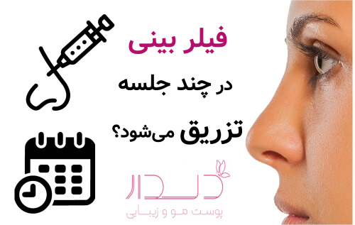 فیلر بینی در چند جلسه تزریق می‌شود؟