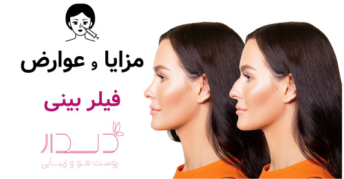 مزایا و عوارض تزریق فیلر بینی در غرب تهران