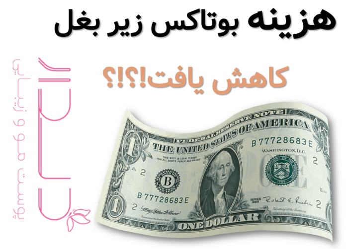 هزینه بوتاکس زیر بغل قیمت بوتاکس زیر بغل