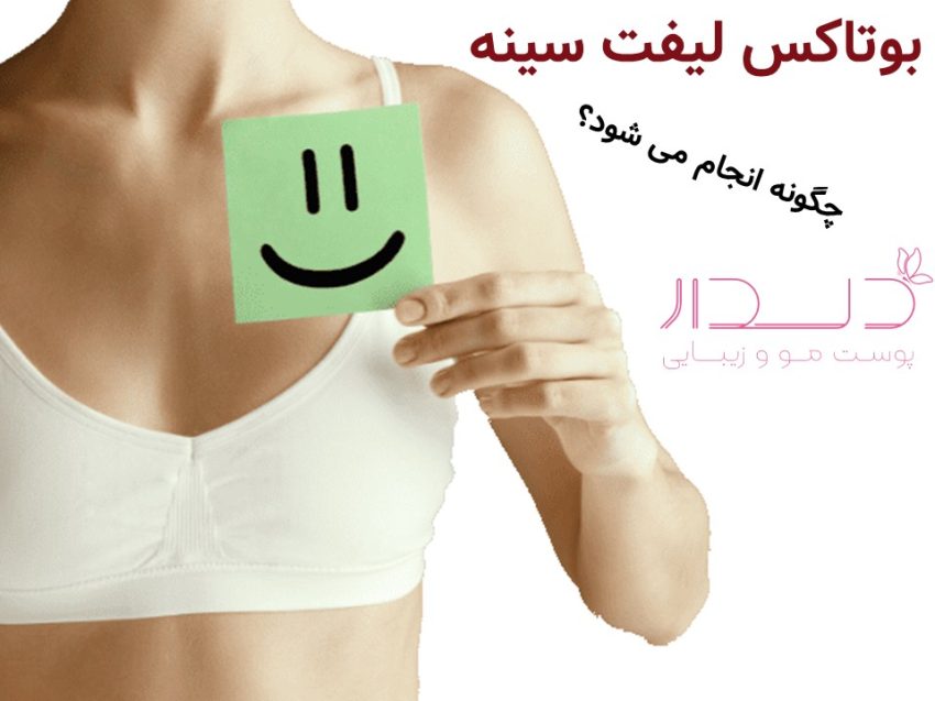 لیفت سینه