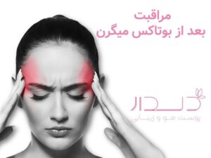 مراقبت بعد از بوتاکس میگرن