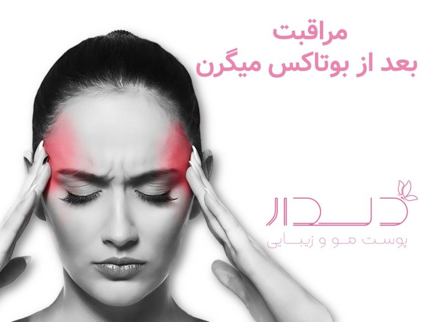 مراقبت بعد از بوتاکس میگرن