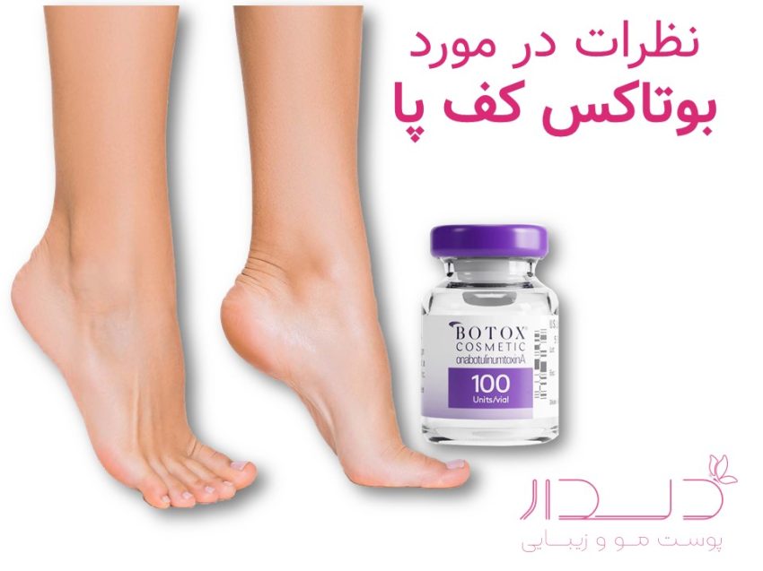 بوتاکس کف پا