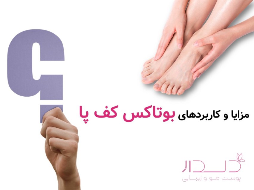 بوتاکس درمانی