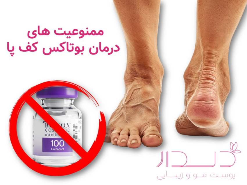 ممنوعیت ها