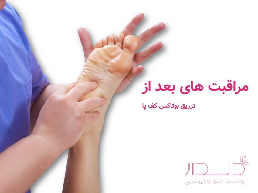 مراقبت ها