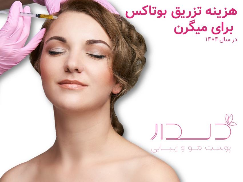 هزینه بوتاکس برای میگرن