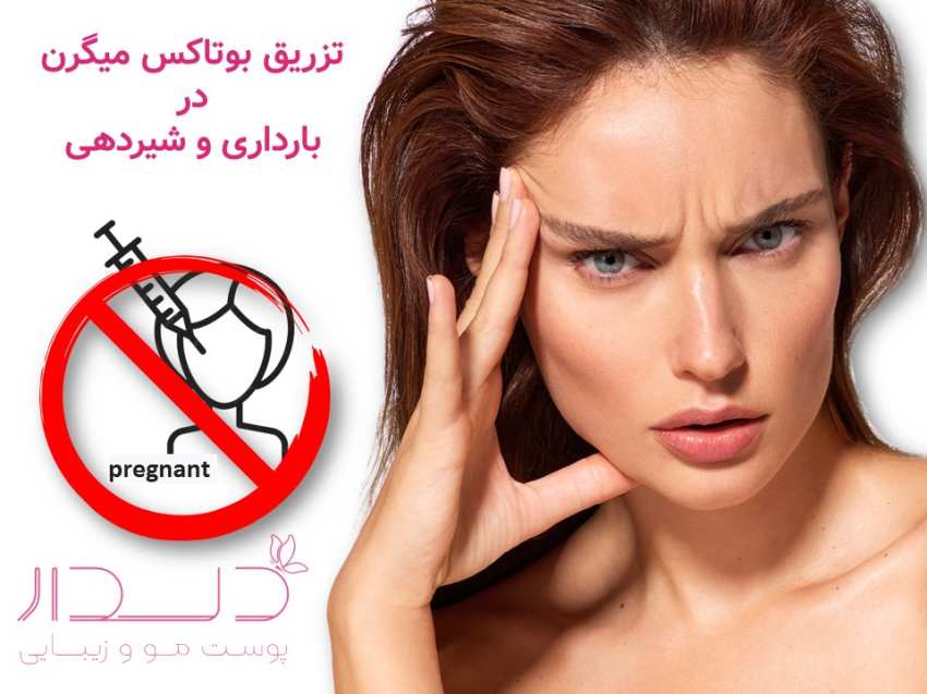 بارداری و بوتاکس
