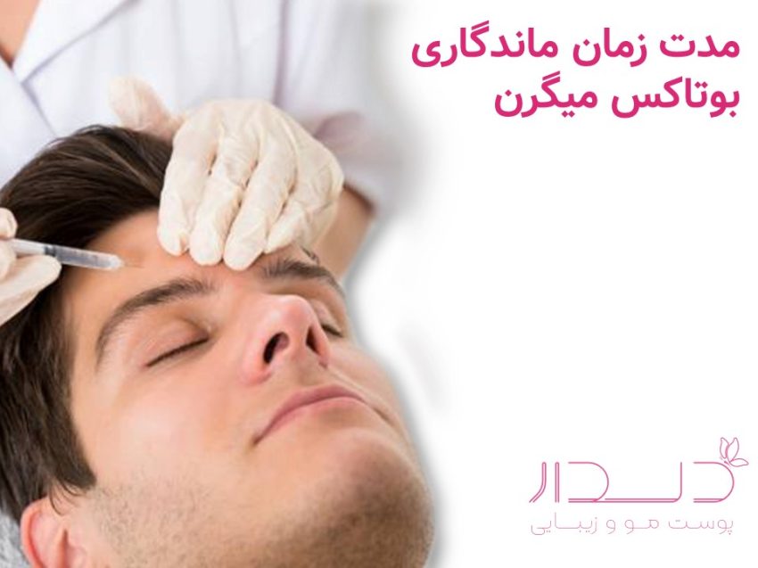 ماندگاری بوتاکس میگرن