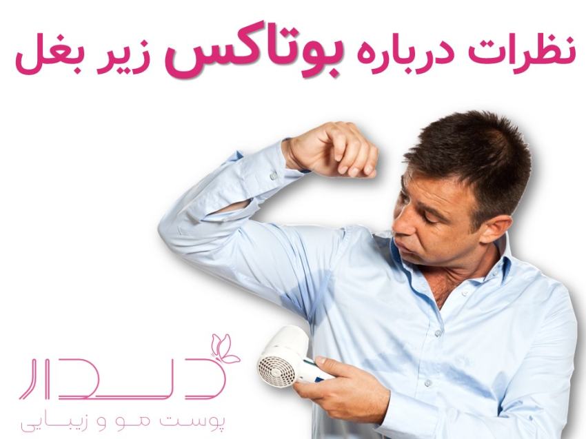 نظرات درباره بوتاکس زیر بغل