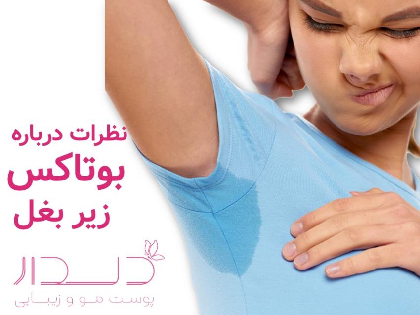 نظرات درباره کنترل عرق بیش از حد زیر بغل
