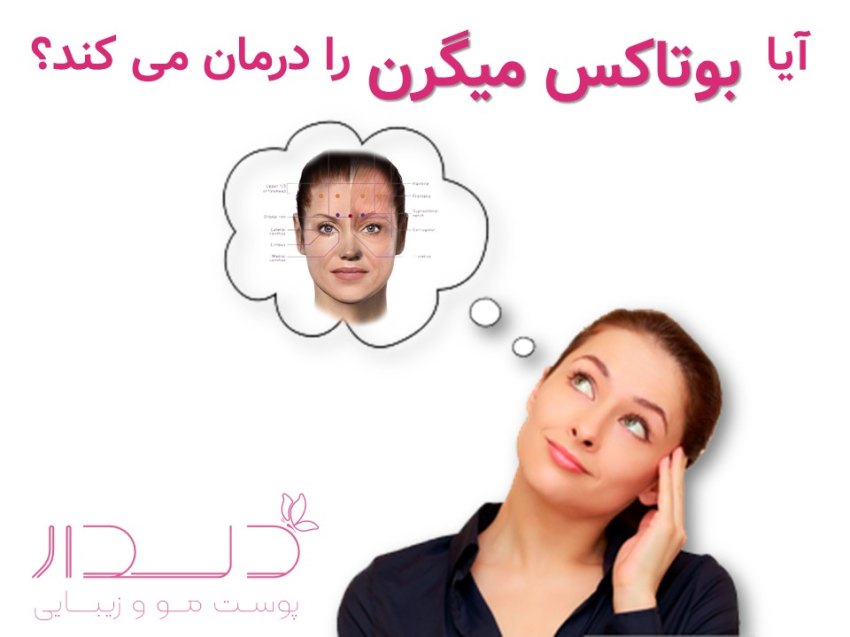 درمان میگرن