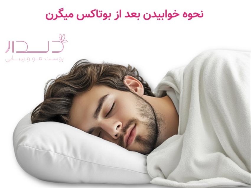 خوابیدن پس از بوتاکس میگرن