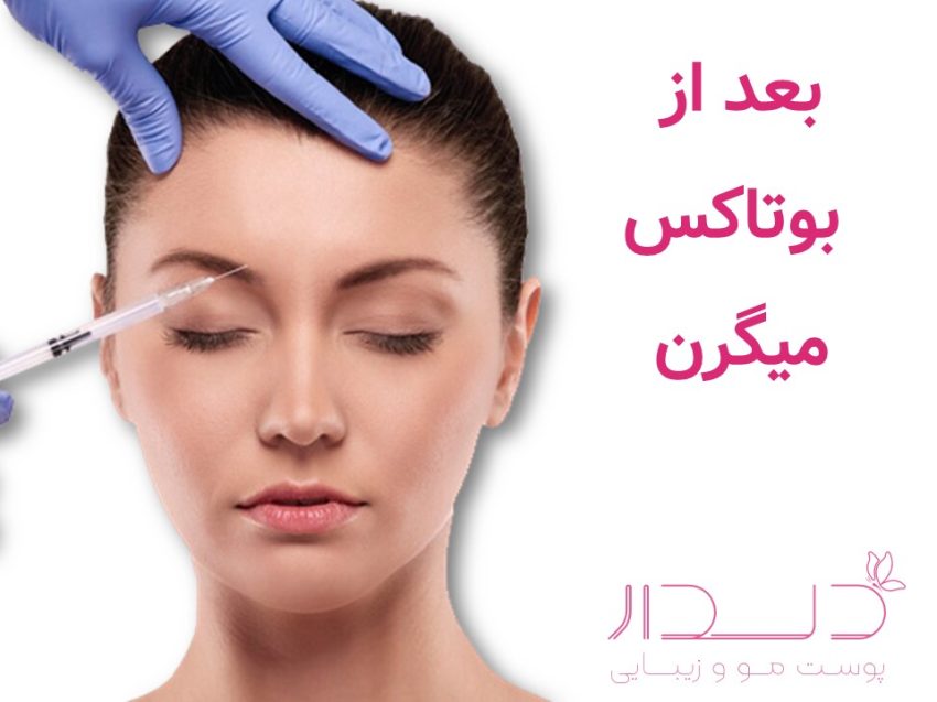 اصلاح صورت بعد از بوتاکس میگرن
