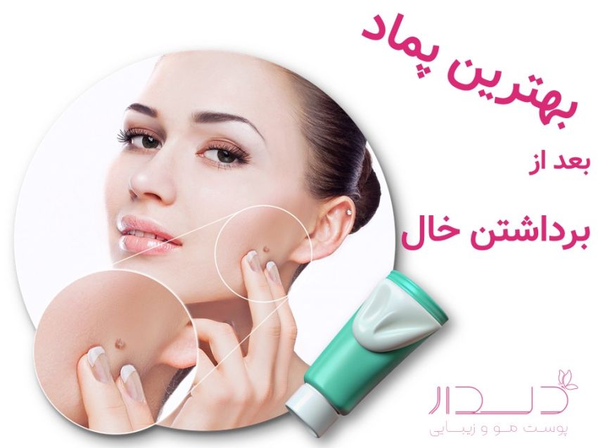 بهترین پماد بعد از برداشتن خال