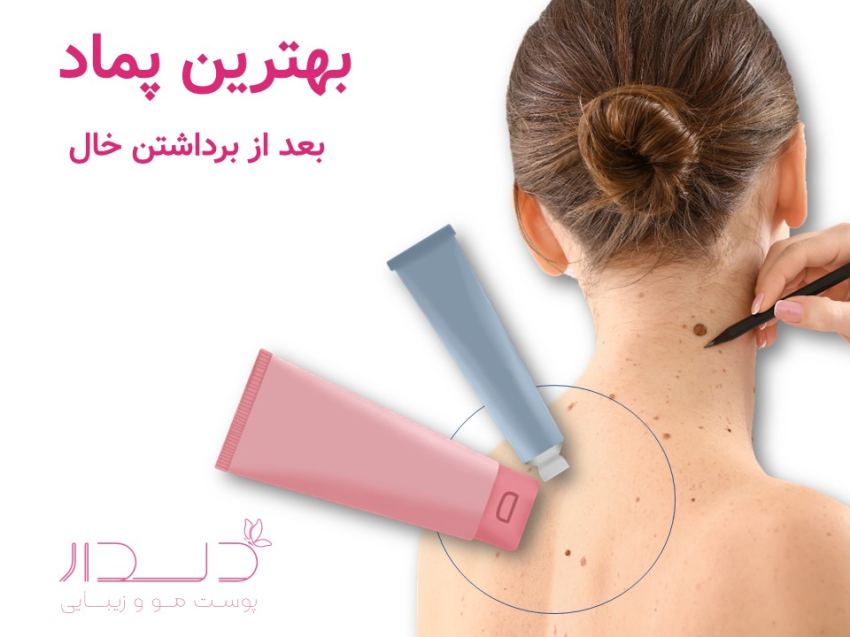 پمادهای مناسب برای بعد از درمان خال