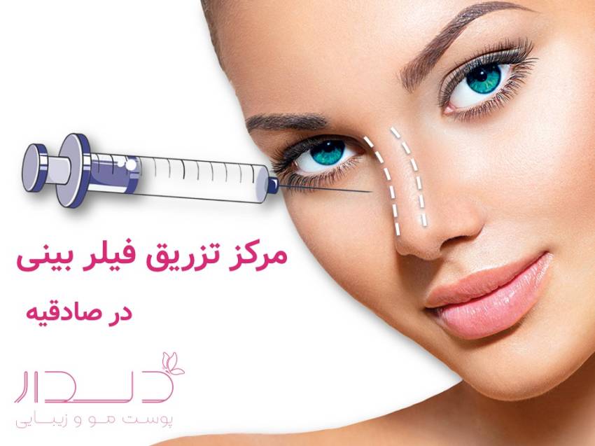 مرکز تزریق فیلر در صادقیه